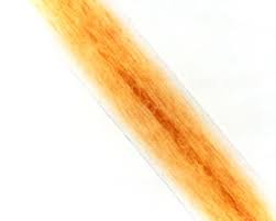 Hair under a stereo microscope. Fbi Forensic Science Communications July 2004