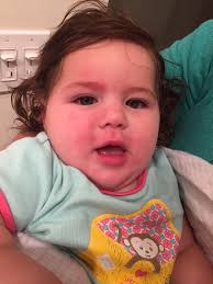 Why is my young Buff chicken's face so red?