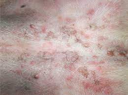 We did not find results for: Superficial Folliculitis Of The Ventral Body In A Staffordshire Bull Download Scientific Diagram