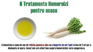 Hemoroizii externi sunt vizibili si apar in partea exterioara a anusului. 6 Tratamente Hemoroizi Externi Si Interni Pe Care Le Poti Face Acasa Cu Efect Youtube
