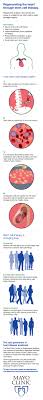 Researchers At Mayo Clinic Harness The Power Of A Patient S Own Stem Cells To Repair Damage Organs Http May Stem Cells Mayo Clinic Cardiovascular Conditions