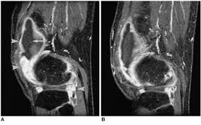 But if they only knew exactly what to do, they'd have no problems seducing and sleeping with older ladies. Mr Images Of A 50 Year Old Woman With Rheumatoid Arthritis Of The Download Scientific Diagram