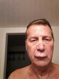 I understand that “county hospitals “.... Does anyone know how Hoag is  doing?