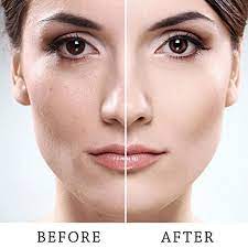 Threading Epilator In 2021 Peach Fuzz On Face Chin Hair Female Facial Hair