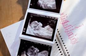 It describes the correct nt scan technique. Pregnancy Scans How Many What To Expect C G Baby Club