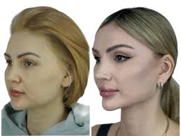 The Evolution of Aesthetic Harmony in Plastic Surgery by Dr. Daniyar  Baibosunov — The NYC Journal