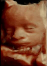 Mein arzt macht es leider nicht und die einzigste. 3d 4d Ultraschall Und Ultraschallbilder Ihres Babys Woman Health Frauenarzt Gynakologie 1010 Wien