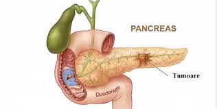 Participa la digerarea alimentelor, metabolizarea nutrientilor si indepartarea toxinelor. Ce Analize Se Fac Atunci Cand Te Doare Pancreasul AflÄ Ce Boli Se Pot Depista Prin Explorarea FuncÅ£ionalÄ A Pancreasului Bodygeek