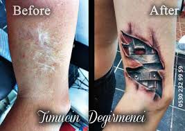 * dövme bakımı nasıl yapılmalıdır? Yanik Izi Kapatma Dovme Tattoo Art Timucin