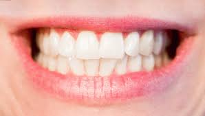 Jess thinks that her bruxism has been triggered by psychological causes. A Breakdown Of Teeth Grinding Vital Record