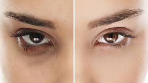 Maybe you would like to learn more about one of these? 15 Penyebab Kantung Mata Hitam Yang Harus Diperhatikan Hot Liputan6 Com