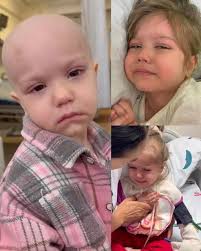 She was born with Cystic Hygroma, a rare condition that fuels her inner  strength as fluid-filled cysts grow under her skin. It makes her tiny neck  swell… sometimes so much that breathing