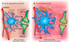 Alzheimer S Disease And Sleep Wake Disturbances Amyloid Astrocytes And Animal Models Journal Of Neuroscience