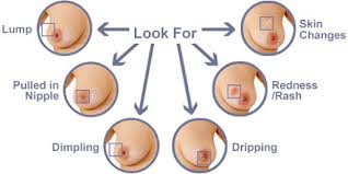 Typically, the first sign of skin cancer is a change in the appearance of your skin. Breast Cancer Symptoms And Signs Healthtipsdoctors