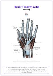 Image result for phlegmon of hand)