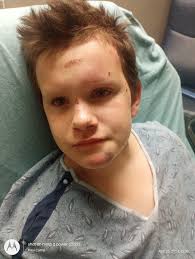 I was in a car accident