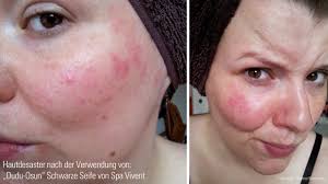 Gelbe wandfarbe und weiße fensterfaschen / türfaschen. Schmutzradierer Aka Zauberschwamm Im Praxistest Vorher Nachher Fotos