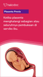 Umat islam wajib mempercayai bahwa hari kiamat pasti akan tiba. Keputihan Bisa Menjadi Tanda Tanda Mau Melahirkan