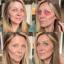 Using Lip and Cheek Shade to Cover Imperfections