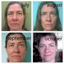 This activity aligns the tissues of the lower eyes and upper cheek. Symmetry Face Yoga Yoga Life