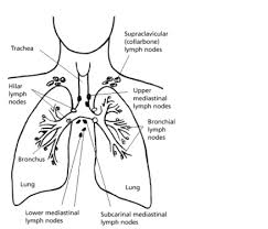 Pin On Cancer Registry Students Lung Cancer