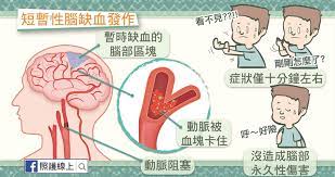 주기적으로 영상 올라오니 많이들 팔로 해주세요. çŸ­æš«æ€§è…¦ç¼ºè¡€ç™¼ä½œ é™ä½Žä¸­é¢¨æ©Ÿæœƒçš„å„ç¨®æ–¹æ³• æ‡¶äººåŒ… ç…§è­·ç·šä¸Š