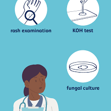 Ringworm, as the fungus is commonly called, is named for the round, raised, red ring appearance usually seen in human ringworm infections. How Ringworm Is Diagnosed