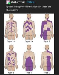 Humans Have Stripes? : R/Curatedtumblr