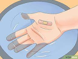 How to remove adhesive from skin. How To Remove A Band Aid Painlessly 9 Steps With Pictures