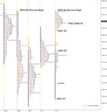 Anomalies Stretched Out Elongated Profile Chart Sp 500 E