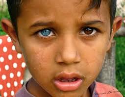 What Color Are Your Eyes Weddingbee Different Colored Eyes Two Different Colored Eyes Heterochromia