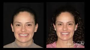 Dentist in Hollywood, FL