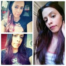 TOP 10 BEST Hair Transplant in Portland, OR