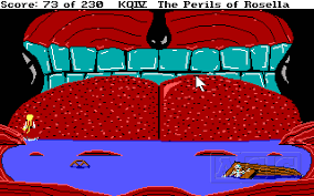 An enlarged uvula is often caused by infection, an allergic reaction, or irritation from chemicals or medical procedures. I Remember We Got Stuck For Ages Inside The Whale In King S Quest You Have To Tickle His Uvula If You Re Playing At Home Painting Challenging Games Spiderman