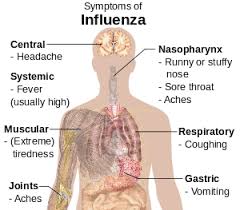 What is a 24 hour stomach bug? Influenza Wikipedia