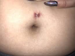 What Is Wrong With My Belly Button Piercing The Skin That The Bar Is Through Is Very Red And Sore Photos