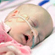 Neonatal services in Wales are at 'high risk'