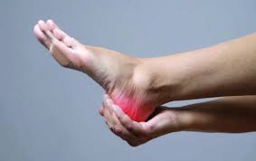 Laser Treatment For Plantar Fasciitis Chiropractic Economics