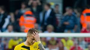 Von 34 spieltagen sicherte sich borussia dortmund die meisterschaft. Bvb Verliert Auch In Koln Fc Bayern Weiter Souveran Fussball