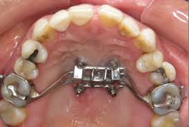 We did not find results for: Blog Foote Orthodontics