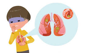 The fast breathing is visible through the rapid movement of the ribs, contraction of abdominal muscles, and flaring of the nostrils. Pneumonia The Silent Killer Of Children Positive Parenting