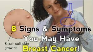 They can vary from painful, hard, and experts do not know exactly why breast cancer develops, but the following risk factorstrusted. Signs Symptoms You May Have Breast Cancer Youtube