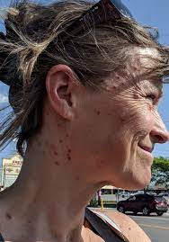Watch the video for black flies from ben howard's every kingdom for free, and see the artwork, lyrics and similar artists. Black Flies Still Swarming In New England Vermont New York In August