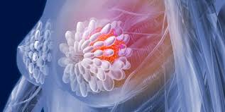 The breast cancer histology image dataset. 10 Ways To Prevent Breast Cancer Breast Cancer Prevention Tips