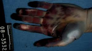 Prosecutors in the trial of jodi arias have entered dozens of graphic crime scene photos into evidence during her. Jodi Arias Crime Scene Photos Warning Graphic Crime Online