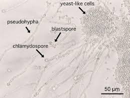 Candida Vulvovaginitis Microscope Candida Albicans Systemic Or Superficial Fungal Infection Candida Yeast Infection Candida Cure Yeast Infection