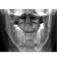 Image result for Incidental Imaging Finding