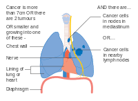 Lung Cancer Wikipedia