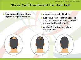 Stem cell + prp therapy for hair growth. Stem Cells Therapy For Hair Loss Affordable Safe Legal