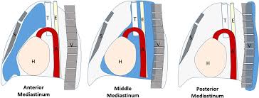 The felson classification is based on the lateral chest radiograph. Https Daneshyari Com Article Preview 2737469 Pdf